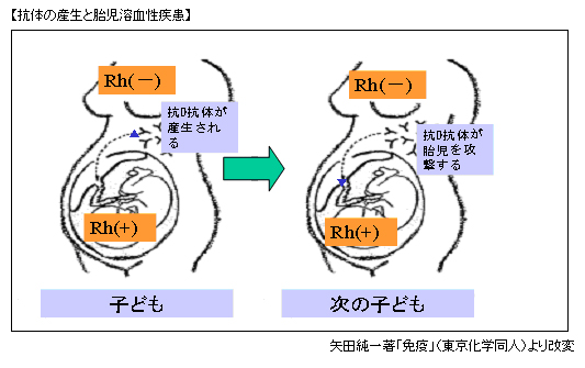 抗体の産生と胎児溶血性疾患