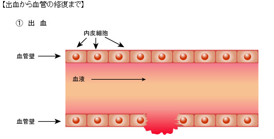 １．出血