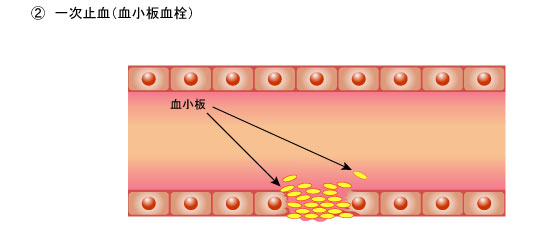 ２．一次止血（血小板血栓）