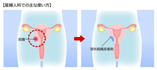 （５）産婦人科での使い方