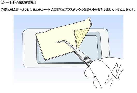 シート状組織接着剤