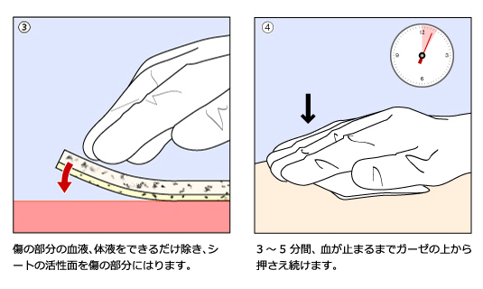 シート状組織接着剤の貼付法-③④