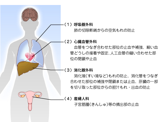 シート状組織接着剤が使用される外科領域