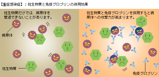 重症感染症：抗生物質と免疫グロブリンの併用効果