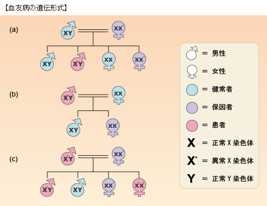 血友病の遺伝形式