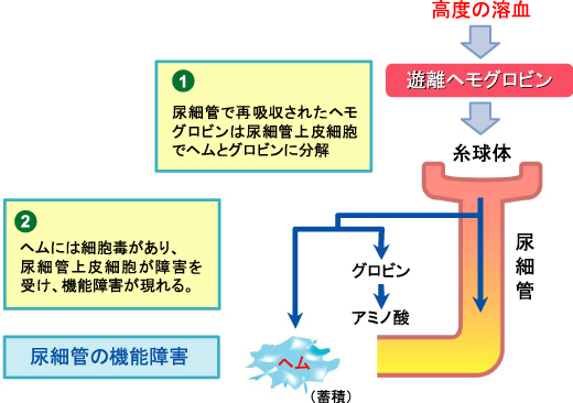 図１−ハプトグロビン製剤